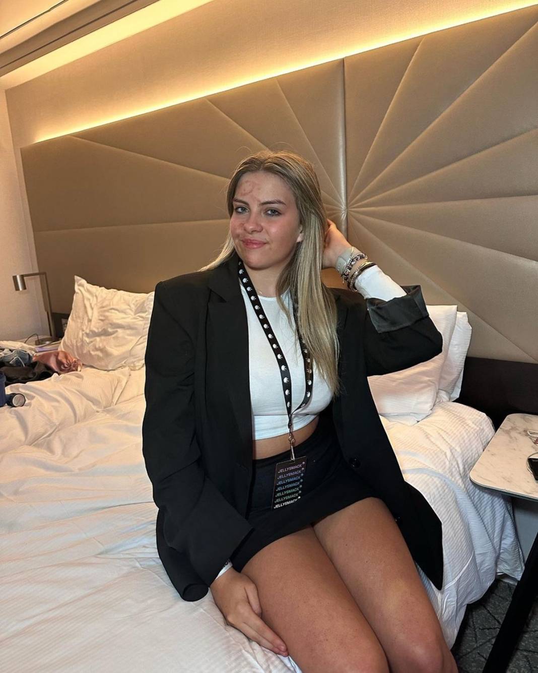 Basit bir uçuk zannetti, korkunç hastalığa yakalandı! Doktorlar bile teşhis koyamadı 19